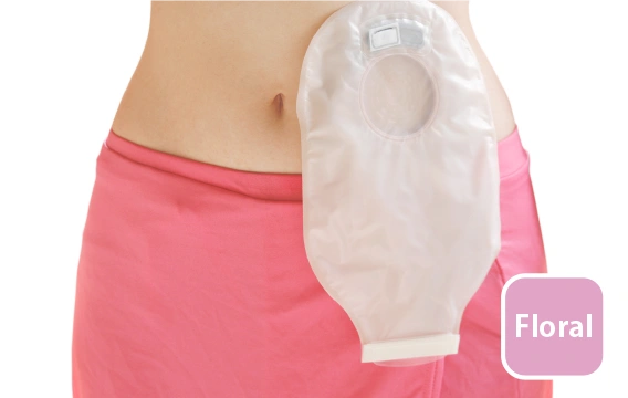 Ostomate (stoma) 
